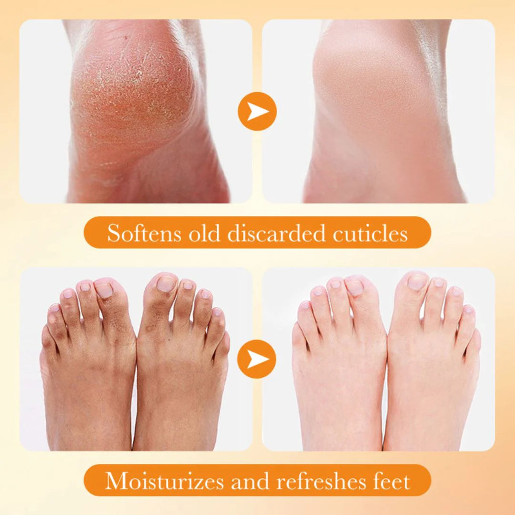 Nourishing Foot Mask with Vitamin C & Niacinamide – Hydrating & Whitening Care for Dry, Cracked Feet